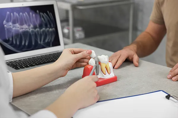 A dentist using a dental implant model to explain the procedure to a patient at Fairbanks Periodontal Associates in Fairbanks, AK